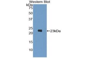Detection of Recombinant PIK3Cb, Human using Polyclonal Antibody to Phosphoinositide-3-Kinase Catalytic Beta Polypeptide (PIK3Cb) (PIK3CB anticorps  (AA 321-507))