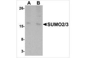 Western blot analysis of SUMO3 in rat liver tissue lysate with SUMO3 antibody at (A) and (B) 2 μg/ml. (SUMO2 anticorps  (C-Term))