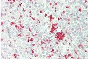 Human Spleen: Formalin-Fixed, Paraffin-Embedded (FFPE) (FBXL5 anticorps  (AA 510-691))