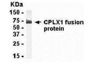 Western Blotting (WB) image for anti-Complexin 1 (CPLX1) (AA 1-134) antibody (ABIN2468059) (Complexin 1 anticorps  (AA 1-134))