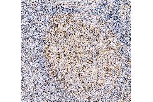 IHC analysis of PD1 using anti-PD1 antibody (ABIN3042500).