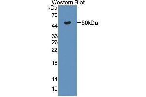 Western blot analysis of the recombinant protein. (CKB anticorps  (AA 11-367))