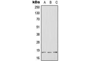 Western blot analysis of HES2 expression in HeLa (A), mouse brain (B), rat brain (C) whole cell lysates. (HES2 anticorps  (Center))
