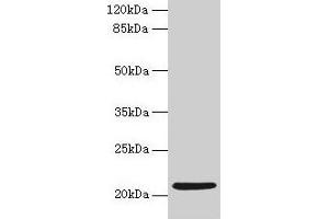 Western blot All lanes: COPZ1 antibody at 1 μg/mL + K562 whole cell lysate Secondary Goat polyclonal to rabbit IgG at 1/10000 dilution Predicted band size: 21, 15, 18, 22, 19 kDa Observed band size: 21 kDa (COPZ1 anticorps  (AA 1-177))