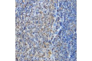 Immunohistochemistry of paraffin-embedded rat spleen using  Rabbit pAb (ABIN6127370, ABIN6137127, ABIN6137128 and ABIN6214982) at dilution of 1:100 (40x lens). (ARPC2 anticorps  (AA 1-300))