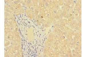 Immunohistochemistry of paraffin-embedded human liver tissue using ABIN7158927 at dilution of 1:100 (MR1 anticorps  (AA 150-253))