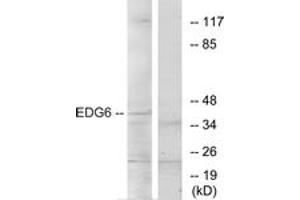 Western blot analysis of extracts from K562 cells, using EDG6 Antibody. (S1PR4 anticorps  (AA 326-375))