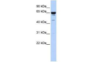 WB Suggested Anti-ZNF587 Antibody Titration:  0. (ZNF587 anticorps  (Middle Region))