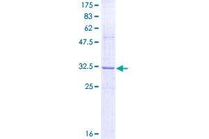 Image no. 1 for Reticulon 3 (RTN3) (AA 84-169) protein (GST tag) (ABIN1318967)