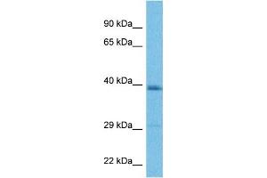 Host:  Rabbit  Target Name:  LAPTM4B  Sample Tissue:  Human MDA-MB-435s Whole Cell  Antibody Dilution:  1ug/ml