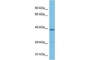 Host:  Rabbit  Target Name:  LAPTM4B  Sample Tissue:  Human MDA-MB-435s Whole Cell  Antibody Dilution:  1ug/ml (LAPTM4B anticorps  (Middle Region))