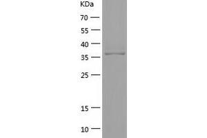 Western Blotting (WB) image for Eukaryotic Translation Initiation Factor 3, Subunit M (EIF3M) (AA 2-374) protein (His-IF2DI Tag) (ABIN7122846)