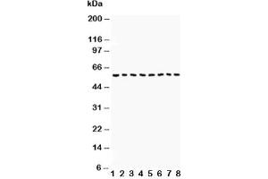 Western blot testing of Beclin 1 antibody and Lane 1:  COLO320;  2: HepG2;  3: PANC;  4: A431;  5: SMMC-7721;  6: Jurkat;  7: SW620;  8: U87 lysate.