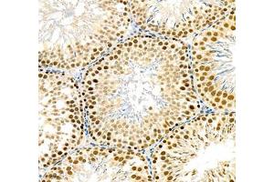 Immunohistochemistry of paraffin embedded rat testis using tfiib (ABIN7074034) at dilution of 1: 900 (250x lens) (GTF2B anticorps)