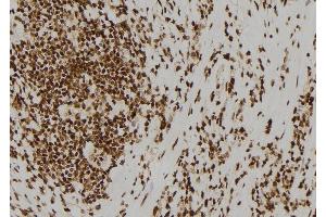 ABIN6278423 at 1/100 staining Human gastric tissue by IHC-P. (ASCL1 anticorps  (C-Term))