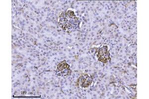 IHC analysis of Integrin linked ILK using anti-Integrin linked ILK antibody (ABIN7599410).