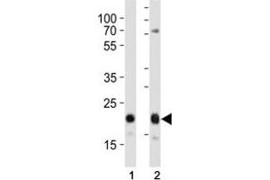 Western blot analysis of lysate from (1) HeLa and (2) MCF-7 cell line using CD9 antibody at 1:1000.