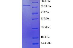 SDS-PAGE (SDS) image for Selectin E (SELE) (AA 23-429), (Extracellular) protein (GST tag) (ABIN5710330)