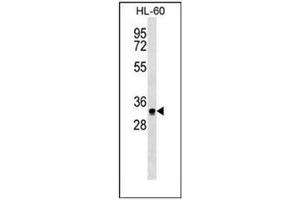 Western blot analysis of SIX3 Antibody  in HL-60 cell line lysates (35ug/lane).