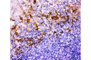 Anti-ITGB1 Picoband antibody,  IHC(P): Human Tonsil Tissue