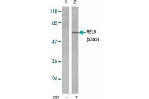 Western blot analysis of extracts from A431 cells untreated or treated with EGF (200 ng/mL 10 min) using RELB (phospho S552) polyclonal antibody . (RELB anticorps  (pSer552))
