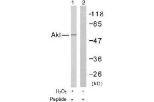 Image no. 2 for anti-V-Akt Murine Thymoma Viral Oncogene Homolog 1 (AKT1) (Thr308) antibody (ABIN197195) (AKT1 anticorps  (Thr308))