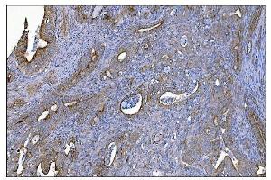 IHC analysis of MERTK using anti-MERTK antibody (ABIN7600623). (MERTK anticorps  (AA 21-489))
