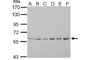WB Image ASC1 antibody detects TRIP4 protein by Western blot analysis. (TRIP4 anticorps)