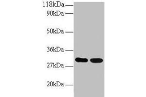 Western blot All lanes: ARHGEF18 antibody at 2 μg/mL Lane 1: EC109 whole cell lysate Lane 2: 293T whole cell lysate Secondary Goat polyclonal to rabbit IgG at 1/15000 dilution Predicted band size: 131, 115 kDa Observed band size: 30 kDa (ARHGEF18 anticorps  (AA 159-551))