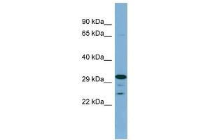 DHRS9 antibody used at 1 ug/ml to detect target protein. (DHRS9 anticorps)