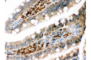 IHC analysis of DARPP32 using anti-DARPP32 antibody (ABIN3044534).