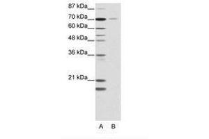 Image no. 1 for anti-Nuclear Receptor Subfamily 2, Group C, Member 1 (NR2C1) (AA 525-574) antibody (ABIN202801) (NR2C1 anticorps  (AA 525-574))