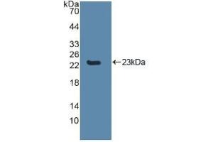 Western blot analysis of recombinant Human CASP8. (Caspase 8 anticorps  (AA 217-384))