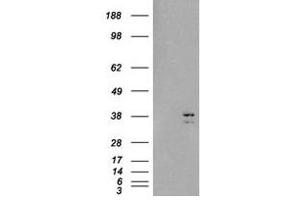 Image no. 2 for anti-Sirtuin 4 (SIRT4) (C-Term) antibody (ABIN374409) (SIRT4 anticorps  (C-Term))