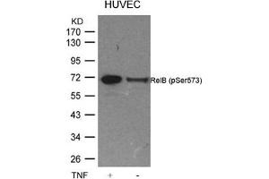 Western blot analysis of extracts from HUVEC cells untreated or treated with TNF using RelB(Phospho-Ser573) Antibody. (RELB anticorps  (pSer573))