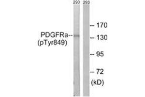 Western blot analysis of extracts from 293 cells, using PDGFRa (Phospho-Tyr849) Antibody. (PDGFRA anticorps  (pTyr849))