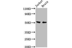 Western Blot Positive WB detected in: Jurkat whole cell lysate, Rat brain tissue All lanes: ONECUT1 antibody at 7. (ONECUT1 anticorps  (AA 192-292))