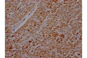 IHC image of ABIN7127355 diluted at 1:100 and staining in paraffin-embedded human heart tissue performed on a Leica BondTM system.