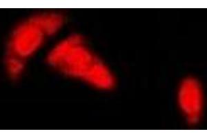 Immunofluorescent analysis of Estrogen Receptor alpha staining in HeLa cells. (Estrogen Receptor alpha anticorps)