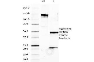 SDS-PAGE Analysis Purified HLA-B Mouse Monoclonal Antibody (JOAN-1). (HLA-B anticorps)