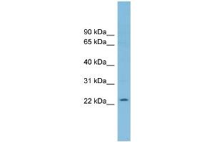 WB Suggested Anti-RNF125 Antibody Titration: 0. (RNF125 anticorps  (Middle Region))