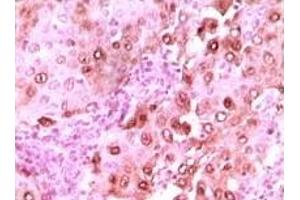 Immunohistochemistry (IHC) image for anti-S100 Calcium Binding Protein A6 (S100A6) (truncated) antibody (ABIN2464024)