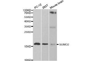 Western blot analysis of extracts of various cell lines, using SUMO2 antibody. (SUMO2 anticorps)