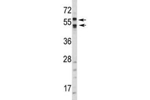 Western blot analysis of CA9 antibody and HepG2 lysate. (CA9 anticorps  (AA 63-90))