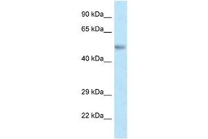 WB Suggested Anti-Pax8 Antibody Titration: 1. (PAX8 anticorps  (C-Term))