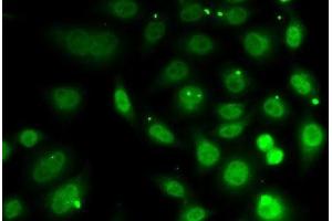 Immunofluorescence analysis of MCF7 cells using DR1 Polyclonal Antibody
