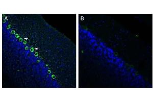 Expression of Renin Receptor in rat cerebellum.