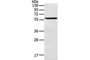 Western Blotting (WB) image for anti-Spermatogenesis Associated 6 (SPATA6) antibody (ABIN2428883) (SPATA6 anticorps)