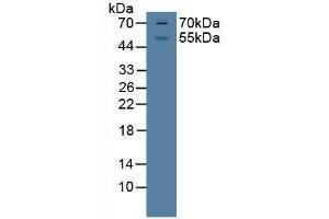 Detection of GR in Porcine Brian Tissue using Polyclonal Antibody to Glucocorticoid Receptor (GR)