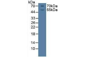 Detection of GR in Porcine Brian Tissue using Polyclonal Antibody to Glucocorticoid Receptor (GR) (Glucocorticoid Receptor anticorps  (AA 598-755))